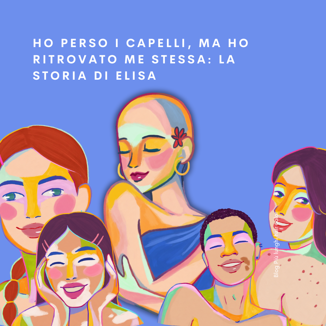 Ho Perso i Capelli, Ma Ho Ritrovato Me Stessa: La Storia di Elisa